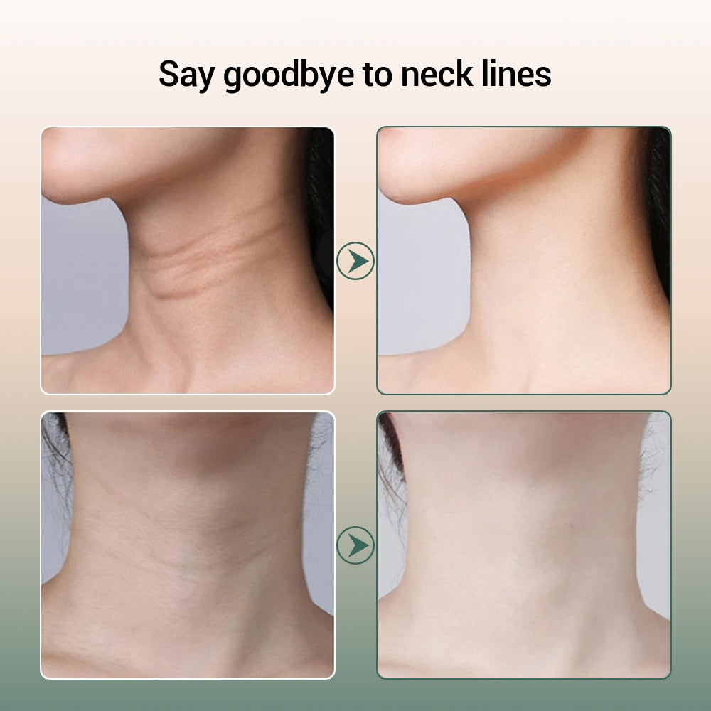 Double Chin Reducer Device